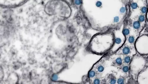 Coronavirus